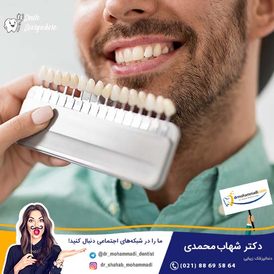 اصلاح طرح لبخند مردانه - کلینیک دندانپزشکی دکتر شهاب محمدی